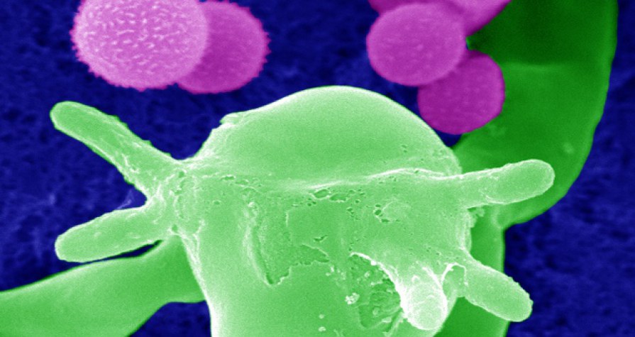 Digitalización de imágenes de microscopio electrónico